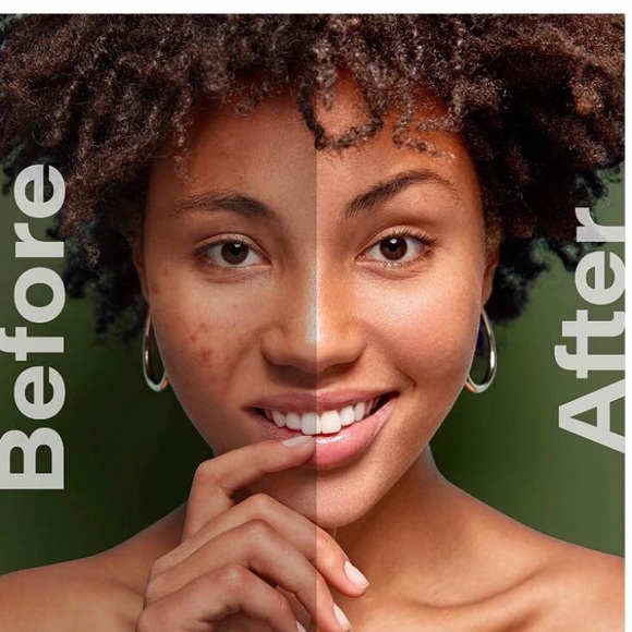 COPY - Tea Tree Foaming Facial Cleanser- 2 Qty - Picture 7 of 7